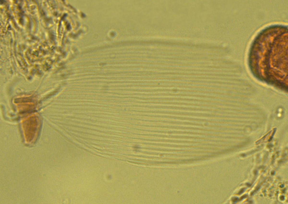 A well-preserved scale extracted from a lake sediment core. Image credit: Montoro Girona et al, doi: 10.3389/fevo.2018.00002.
