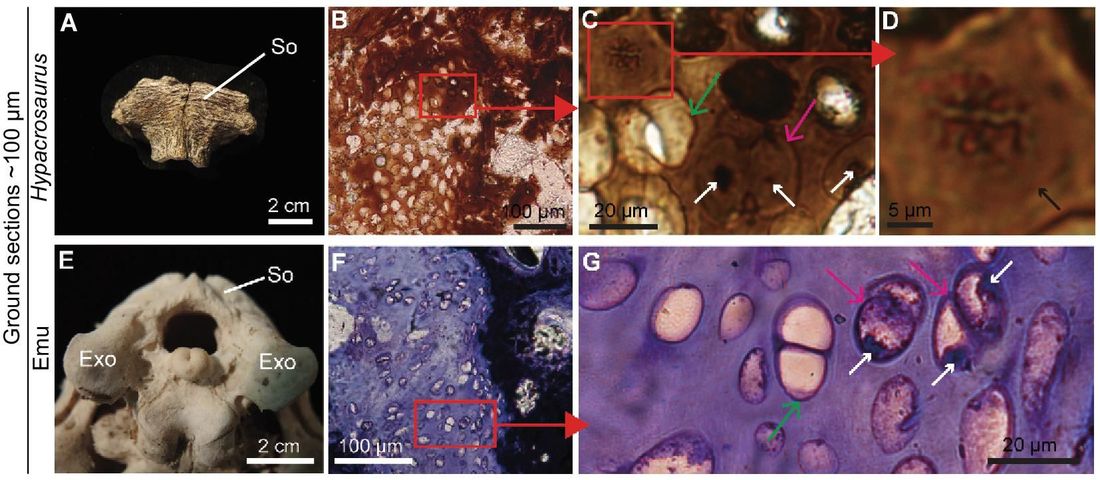 Ground section of Hypacrosaurus (MOR 548) supraoccipital shows exceptional histological preservation of calcified cartilage. (A) An isolated supraoccipital (So) of Hypacrosaurus in dorsal view. (B–D) Ground section of another So showing calcified cartilage with hypertrophic chondrocyte lacunae. (C) Some cell doublets appear empty (green arrow), but others (pink arrow) present darker, condensed material consistent in shape and location with a nucleus (white arrows). (D) Dark, condensed, and elongated material with morphological characteristics of metaphase chromosomes.